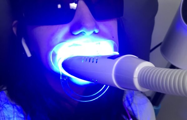 Everbrite Teeth Whitening Salon Gallery 0